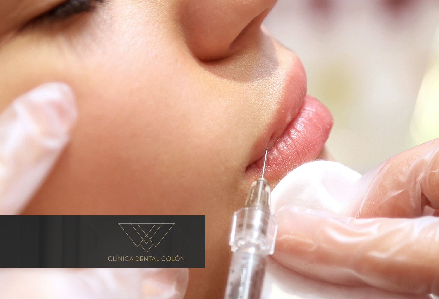acido-hialuronico-en-castellon-labios-clinica-raquel-colon Ácido Hialurónico en Castellón ¡recupera tu juventud!